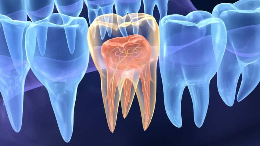 پرکردن کانال ریشه دندان